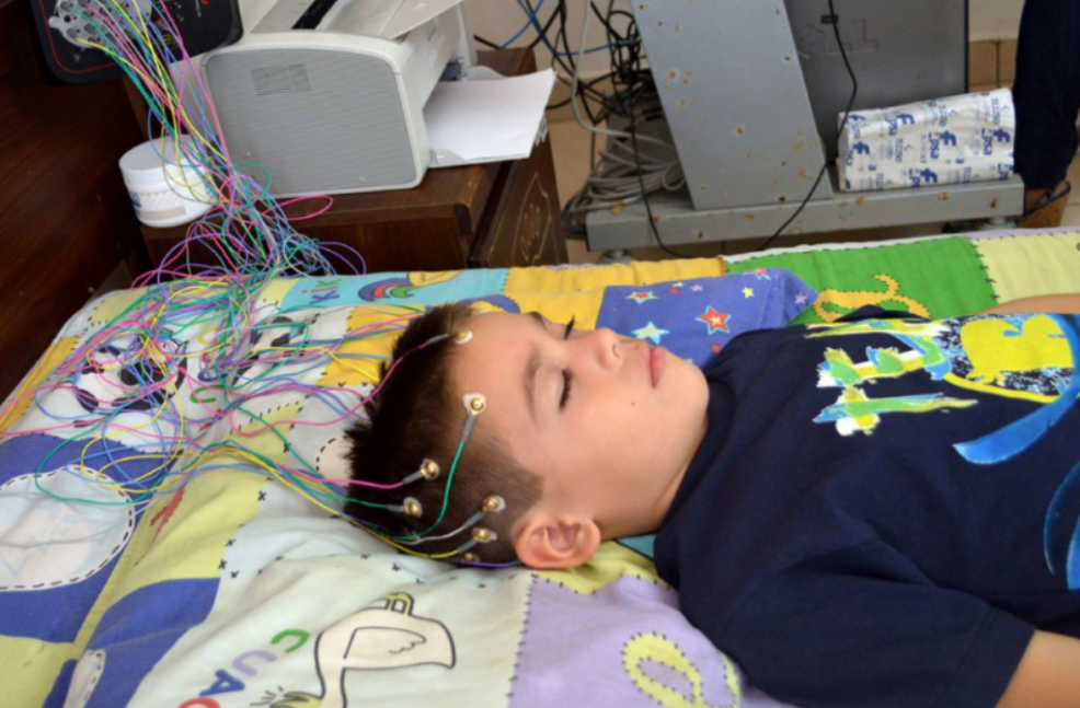 Electroencefalograma computarizado